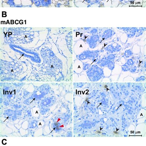 Immunohistochemical Localization Of Lipid Transporters At Specific