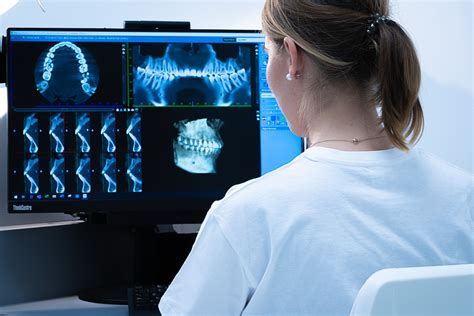 CBCT Cone Beam Computed Tomography Zobni Rentgen RTG Si