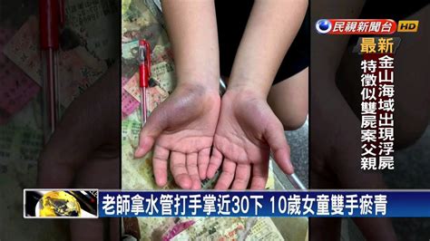 安親班師水管打手近30下 10歲女童雙手瘀青－民視新聞 Youtube