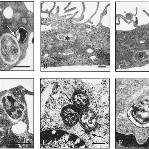 Ultrastructural Observations On Brucella Bearing Phagosomes In Human Download Scientific