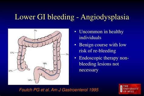 Ppt Major Lower Gastro Intestinal Bleeding Powerpoint Presentation Free Download Id6335371