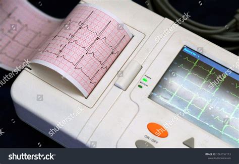 Parts Of A Ecg Machine At Jesse Sauers Blog