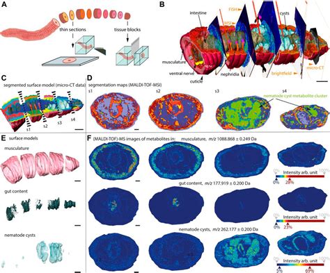 Frontiers Advances In MALDI Mass Spectrometry Imaging Single Cell And