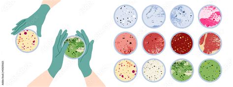 Scientists Hand In Glove Holding Petri Dish Plate With Agar