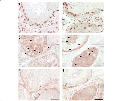 Immunohistochemical Analysis Of Cell Sex Hormone Receptors Pictures A