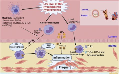 Schematic Presentation Of Atherosclerotic Plaque Formation With The