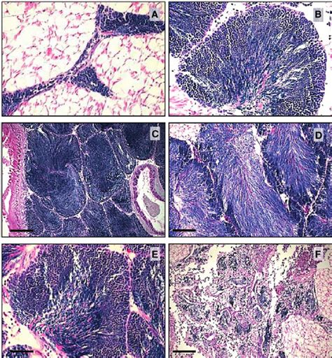 Photomicrographs Of Gonadal Stages In A Male Cerastoderma Edule A