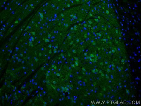 Pcp4 Antibody Cl488 14705 Proteintech