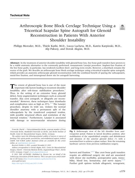 Pdf Arthroscopic Bone Block Cerclage Technique Using A Tricortical