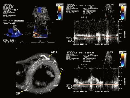 A Ecocardiografia Em Casos Especiais Parte Blog Ecope