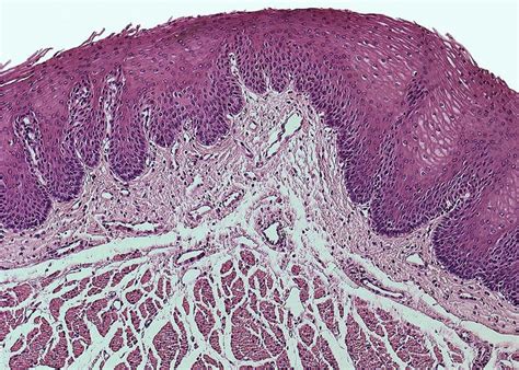 Stratified Squamous Epithelium Mucosa Greeting Card By Science Stock