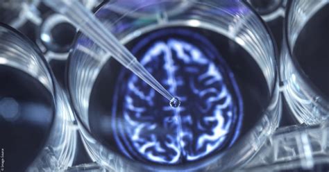 Predicting Dementia Using Neural Network Characteristics