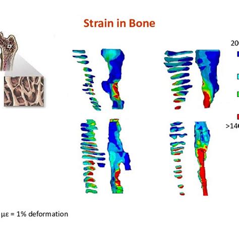 Mechanical Loading Of Bone Results In Deformation Strain Of