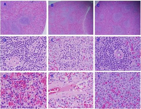 Representative Spleen Histological Sections Stained With Hande Of Control Download Scientific