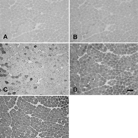 Photomicrographs Of Immunoperoxidase Stained Semiserial Sections Of The