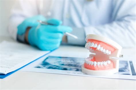 pay  dental implants implant financing options
