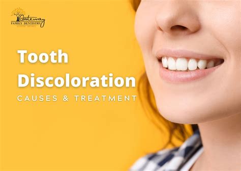 Tooth Discoloration Causes Prevention Solutions Gateway