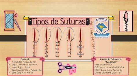 Tipos De Suturas Udocz