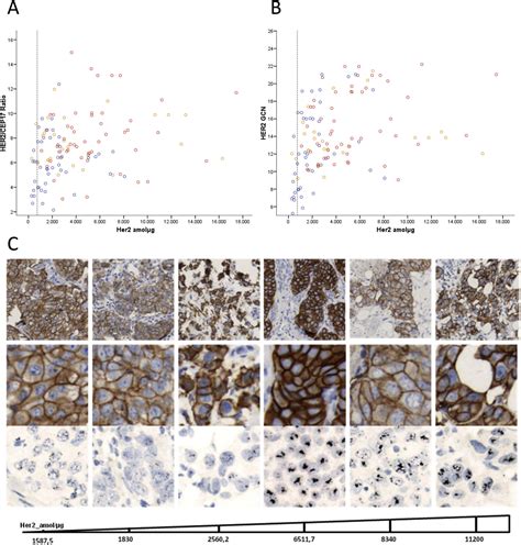 High Her2 Protein Levels Correlate With Increased Survival In Breast