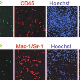 Pancreatic Engraftment Of Bone Marrow Derived GFP Cells In