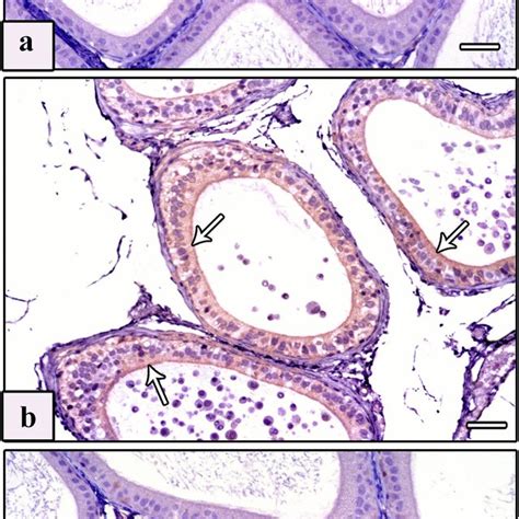 Photomicrographs Of Sections Of Epididymis Of Studied Rat Groups With