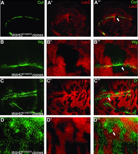 Wdr62 Regulates Notch Signaling In The Wing Imaginal Disc In Wdr62