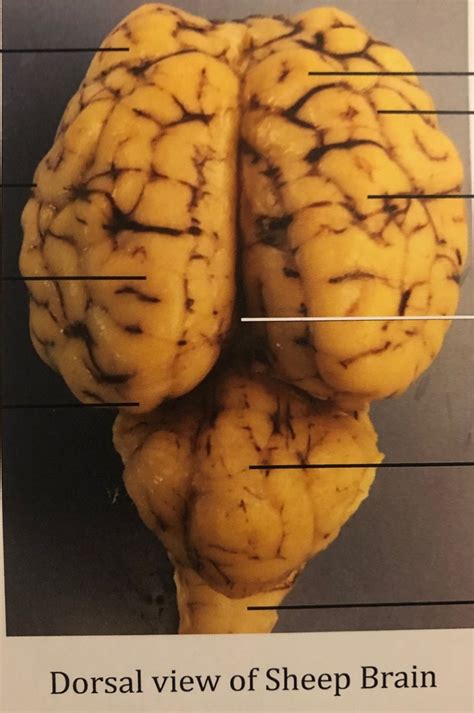 Brain Dorsal View Diagram | Quizlet
