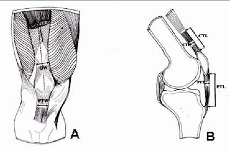 A Frontal View Of The Knee Region With Morphometric Parameters Shown