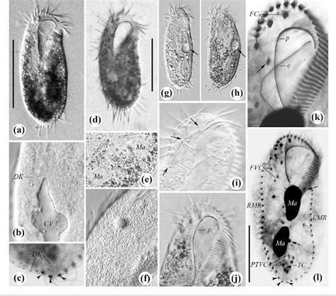 Morphology And Morphogenesis Of A Soil Ciliate Rigidohymena Candens