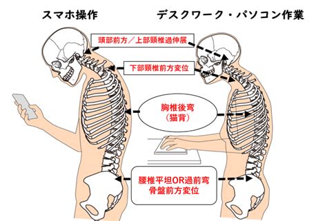 ストレートネック│とくやま徒手療法研究所・施術院