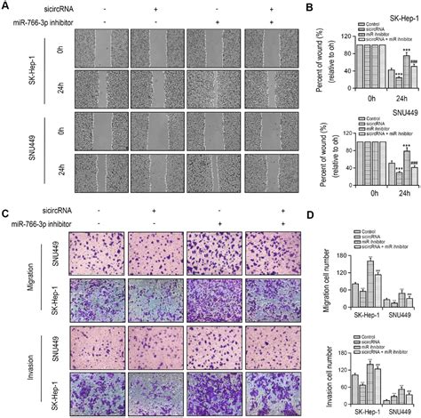 Circular Rna Hsa Circ Functions An Oncogenic Gene In