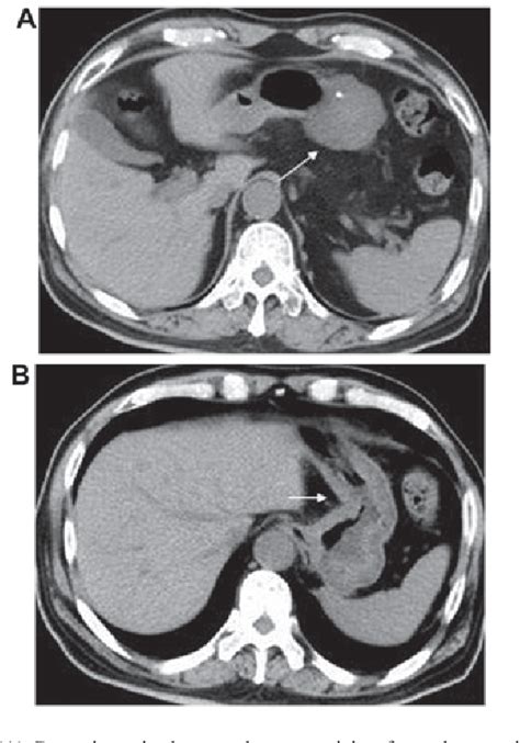 Figure From Computed Tomography Imaging Characteristics Of