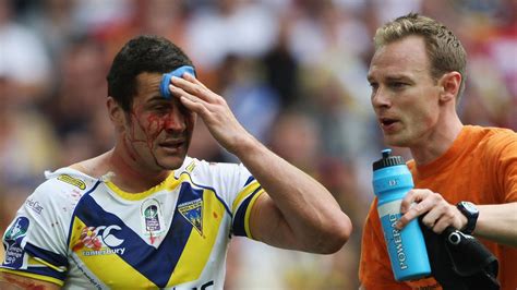 Phil Clarke Looks At The New Concussion Protocols In Rugby League