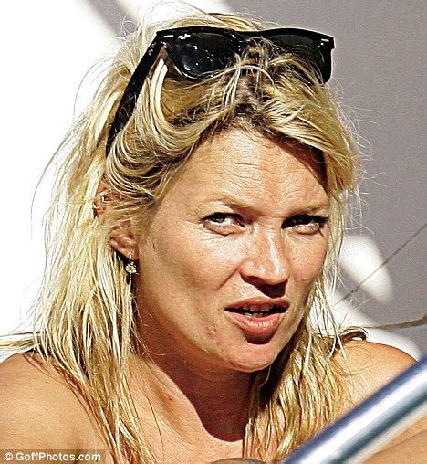 Why Does Kate Moss Look So Bad We Reveal How Her Party Lifestyle Has Finally Caught Up With Her