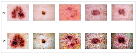 Diagnostics Free Full Text Skinnet Inio Multiclass Skin Lesion