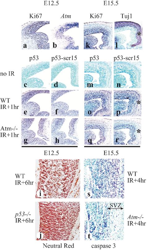 Figure 3 From Ataxia Telangiectasia Mutated Dependent Apoptosis After