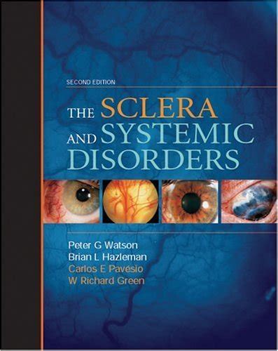 Sclera & Systemic Disorders - Green MD, W. Richard; Hazleman MA FRCP ...