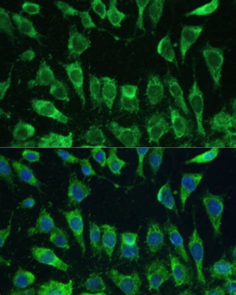 Galectin Polyclonal Antibody Invitrogen L Unconjugated