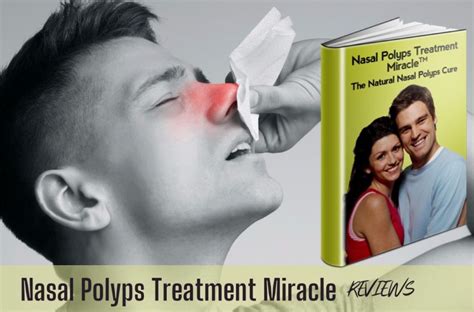 Nasal Polyps Treatment Miracle Reviews 2023 • Consumer Report