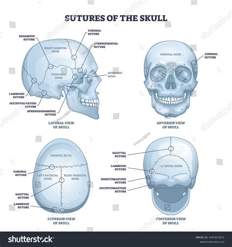 Sagittal View Of Skull