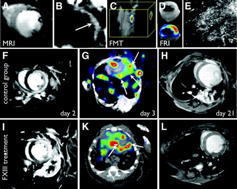 Multimodality Cardiovascular Molecular Imaging Part Ii Circulation