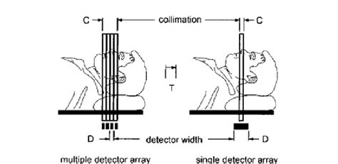 With A Single Detector Array Ct Scanner The Collimation Width Is