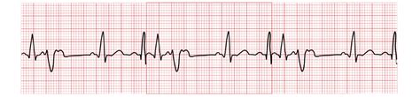 The Importance of Telemetry Units in the COVID-19 Pandemic