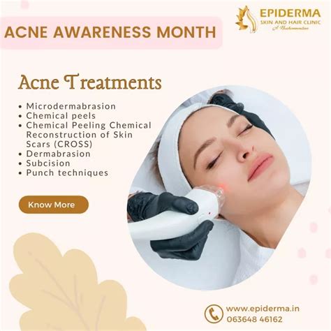 Ppt Acne Treatments Best Skin Clinic In Jayanagar Bangalore Epiderma Clinic Powerpoint