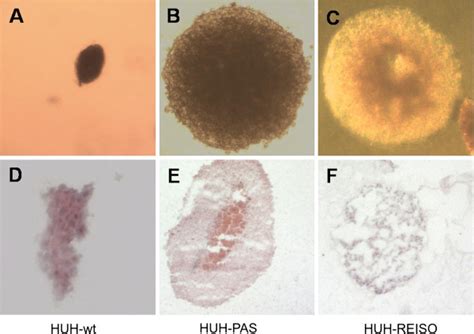 Anchorage Independent Growth Multicellular Spheroids Grew From A