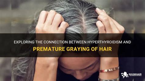 Exploring The Connection Between Hyperthyroidism And Premature Graying