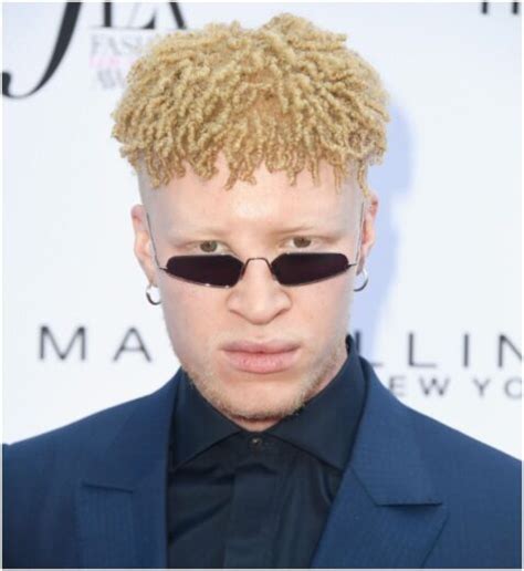 Famous People With Albinism Health Guide Net