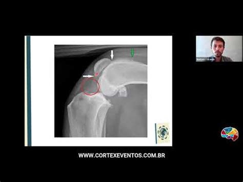 Aula Insuficiência do Ligamento Cruzado Cranial Profº Gustavo Vicente