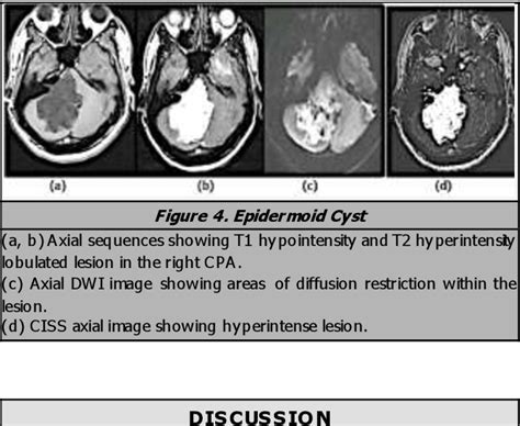 Figure From Magnetic Resonance Imaging Evaluation Of Extra Axial