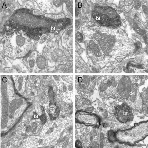 Serial TEM Micrographs Of BDA Labeled VPMdm Thalamocortical Boutons